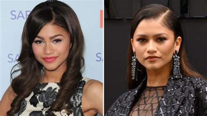 Unveiling Zendaya's Plastic Surgery Secrets: A Journey Of Discovery
